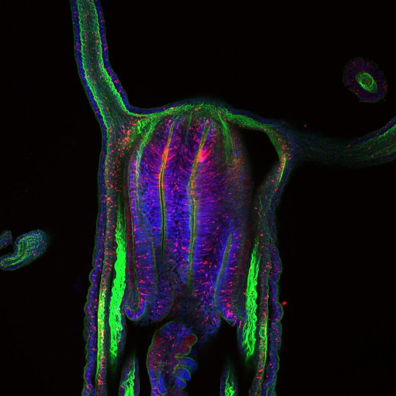 Optical longitudinal section of sea anemones